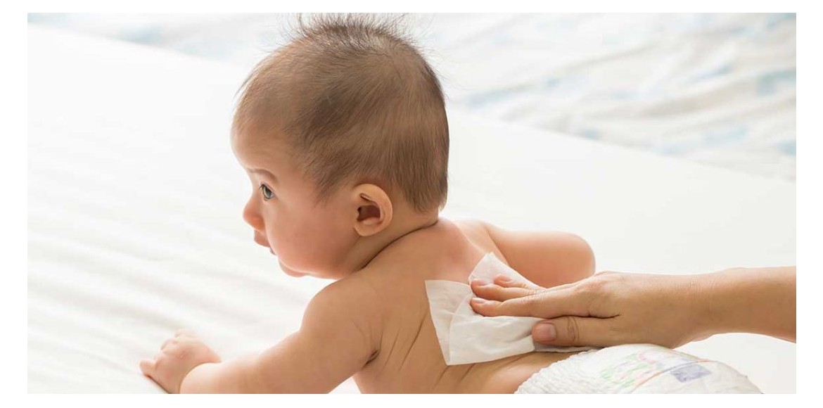 rekomendasi tisu bayi yang aman